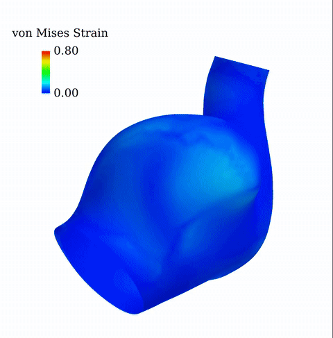 1754400865703316.gif 动脉瘤应变_压缩.gif